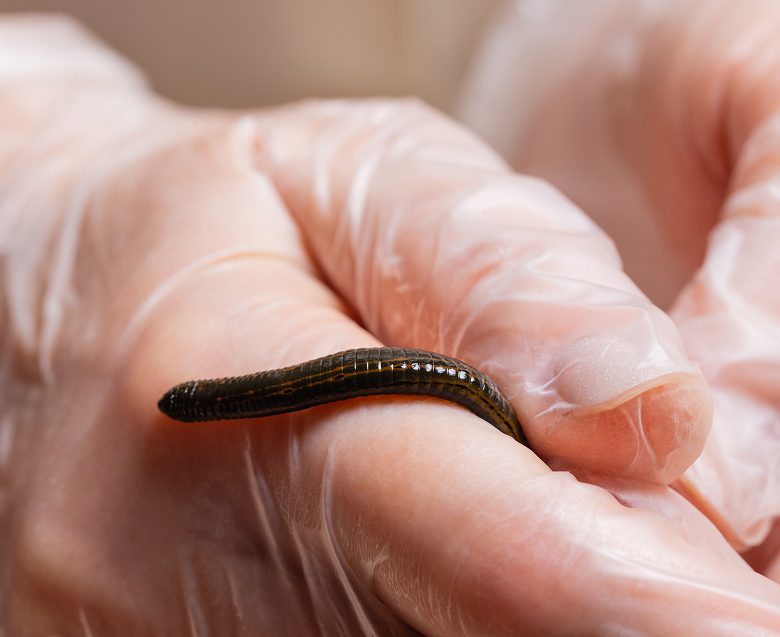 Гирудотерапия