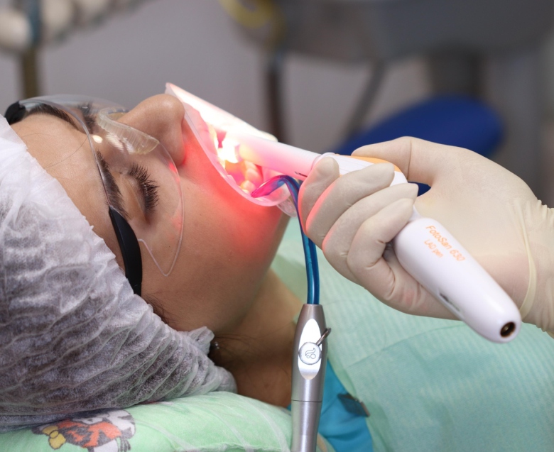 ФДТ в стоматологии