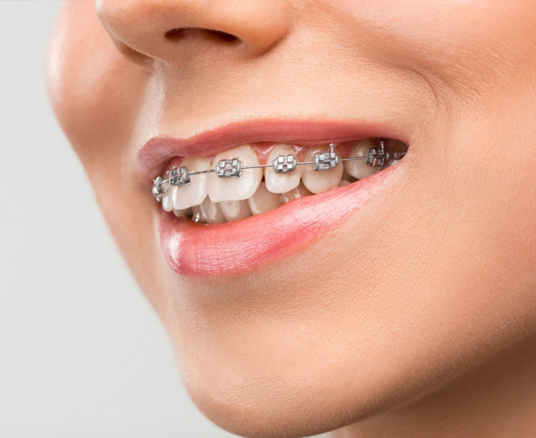 Ортодонтия